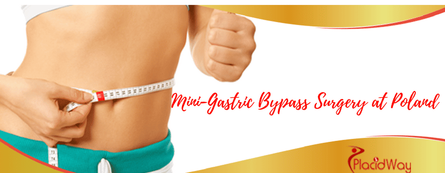 Gastric Mini Bypass Surgery Poland